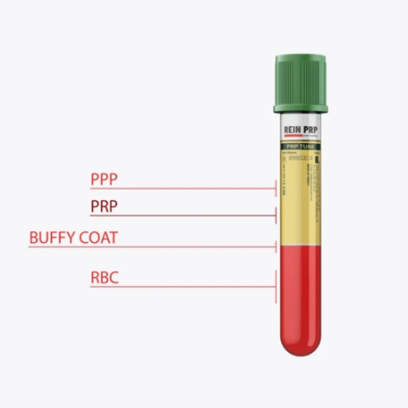 KIT PRP REIN DUO para Plasma Rico en Plaquetas