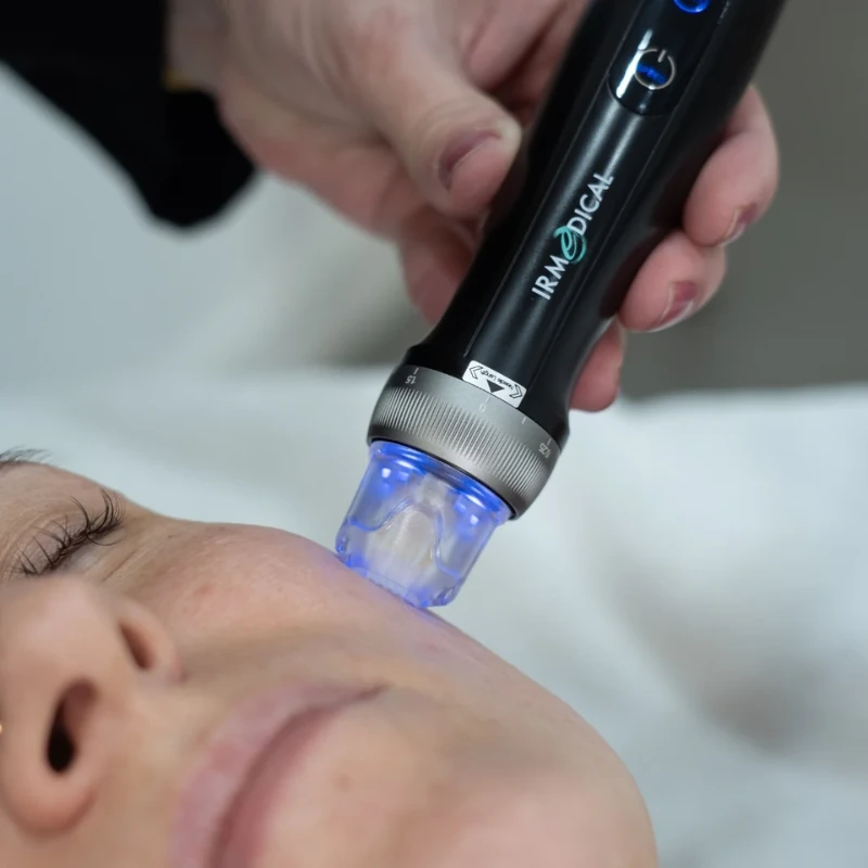 Active Derma IR