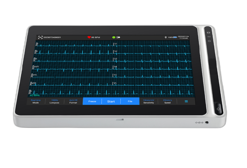 ECG 12can NeoECG T180 con interpretación - Imagen 7
