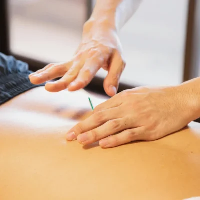 Agujas de fisioterapia