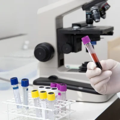 Tubos para extracción