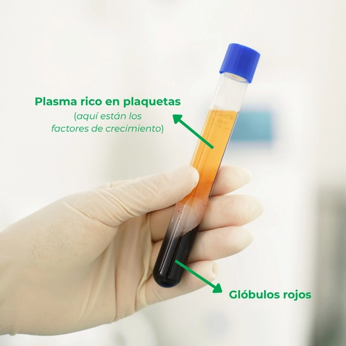 Separación glóbulos rojos y plasma