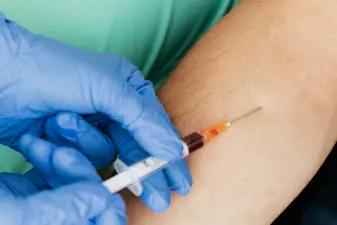 Personal sanitario con guantes azules aplica una inyección intradérmica en el antebrazo con una jeringa fina.