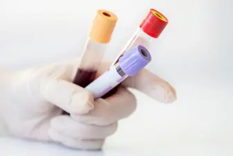Mano con guante blanco sosteniendo tres tubos de extracción de sangre al vacío con tapones de colores amarillo, rojo y morado.
