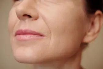 Detalle del rostro de una mujer mostrando los surcos nasogenianos para tratamientos de medicina estética facial.