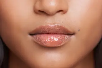 Primer plano de los labios hidratados y la zona perioral de una mujer en una consulta de estética.