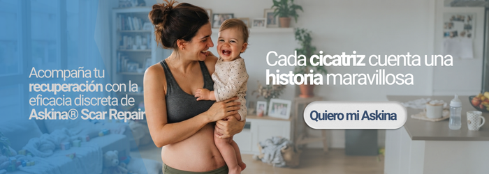 Madre sonriendo mientras sostiene a su bebé en brazos en un ambiente hogareño, con textos promocionales de Askina Scar Repair.